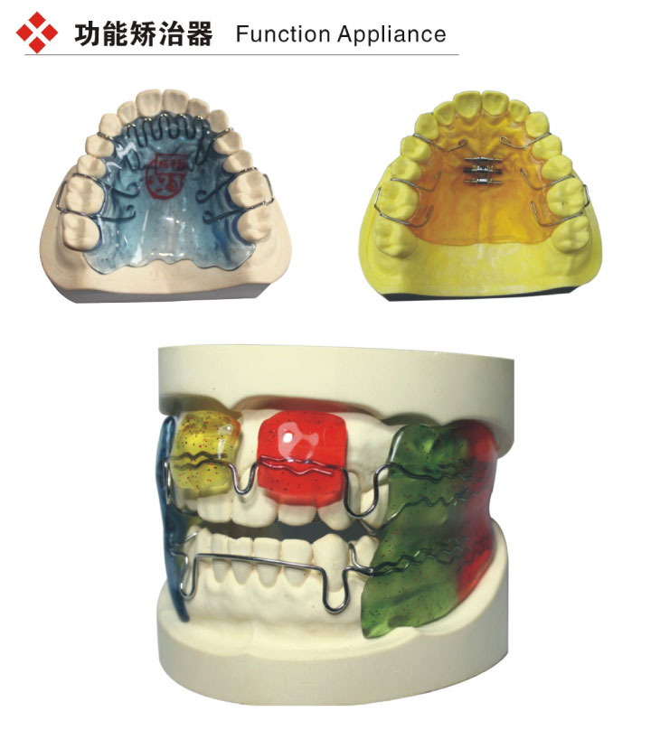 功能矫治器